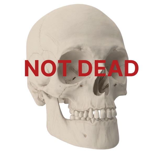 Not Dead Still Alive